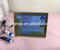 Digital Skin And Hair Analyzer Machine