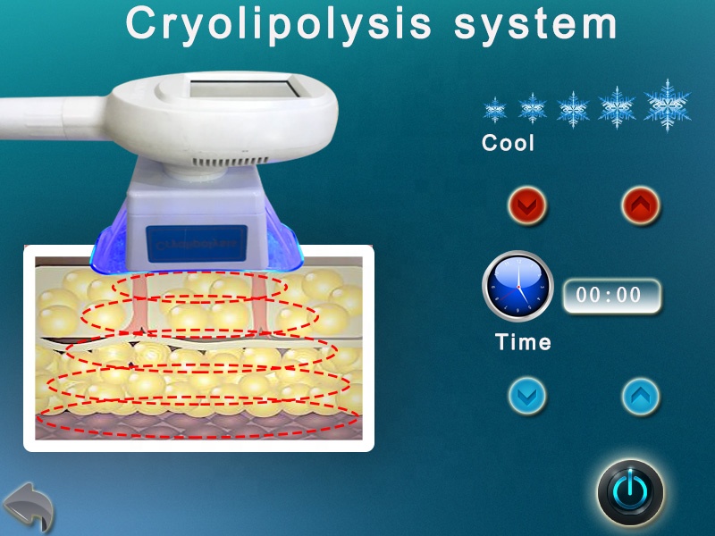 2019 new model one cryo handle portable cryolipolysis machine fat freeze