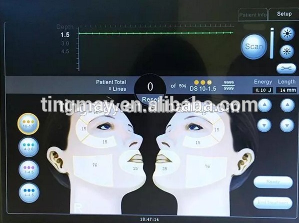 Small High Intensity Focused Ultrasound HIFU Machine For Wrinkle Removal And Face Lift
