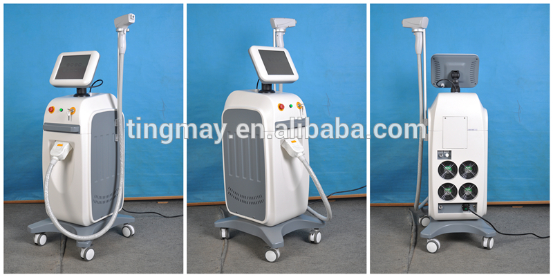 808nm diode laser hair removal permanent