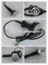 ultrasound liposuction equipment explosive speed grease