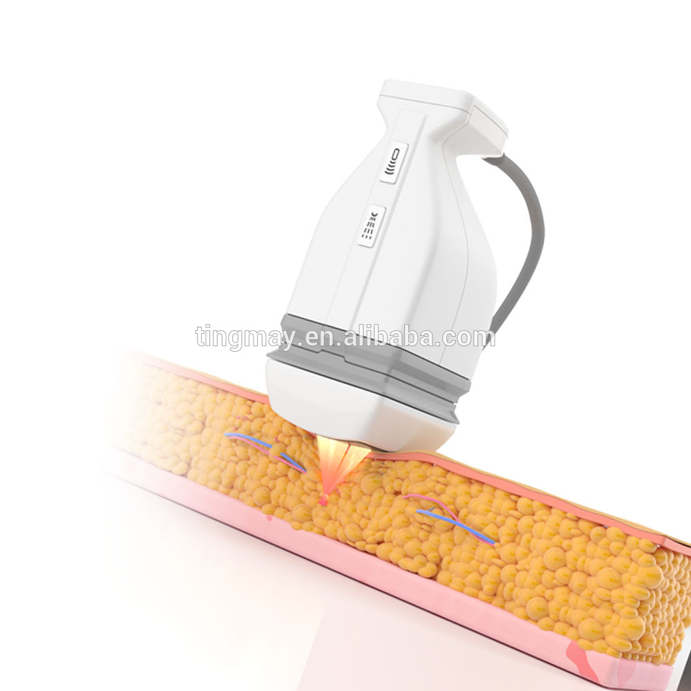 LIPO HIFU ultrasound weight loss machine HIFU slimming machine