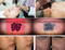 Professional salon furniture picosecond laser for tattoo removal machine TM-P010